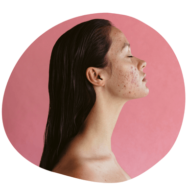 Team Dermatologicznie